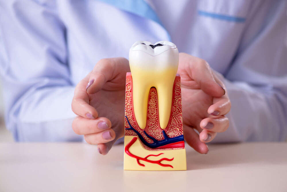 Les extractions dentaires : un acte chirurgical encadré - La maison dentaire