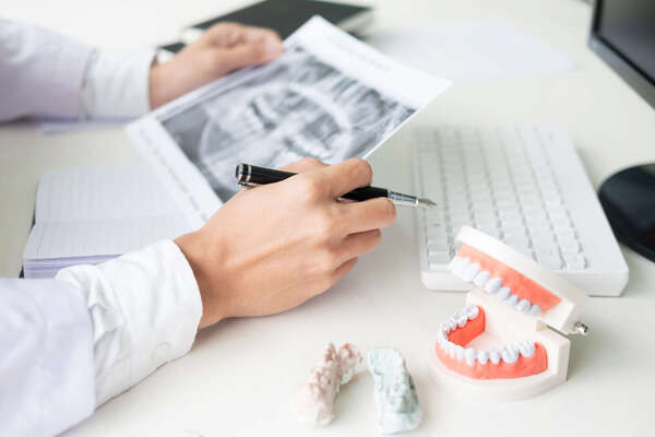 La maintenance parodontale : un suivi essentiel après traitement ou pose d’implants - La maison dentaire