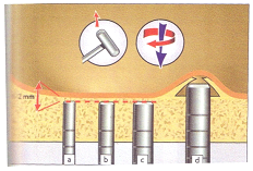 LES IMPLANTS DENTAIRES, GREFFE OU COMBLEMENT DES SINUS EN VUE DE LA POSE DES IMPLANTS - TOURS