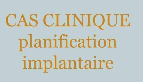 La planification Implantaire