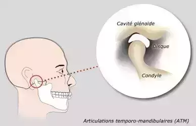 DAM ET ARTICULATIONS TEMPORO-MANDIBULAIRES (ATM)