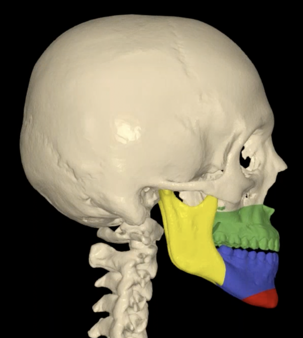 Chirurgie des mâchoires