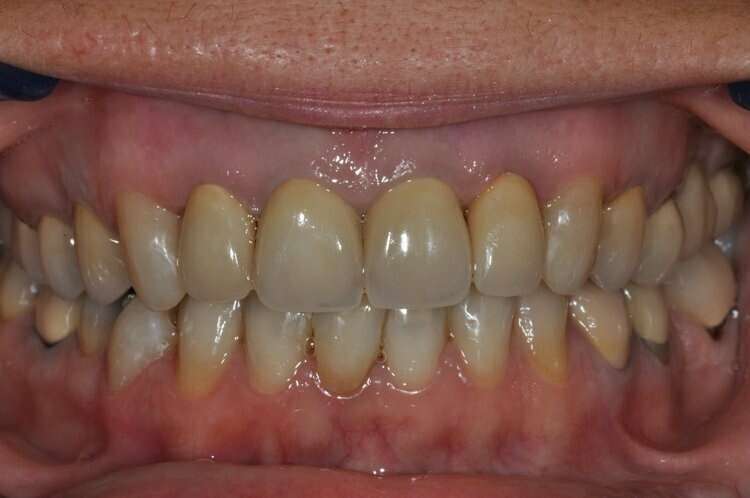  Après Réhabilitation du sourire