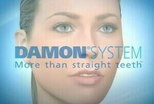 Système Damon