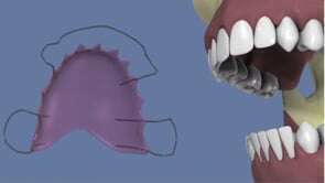 Contention de hawley