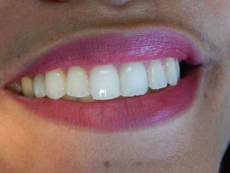 kkikhygmz4_1595417809