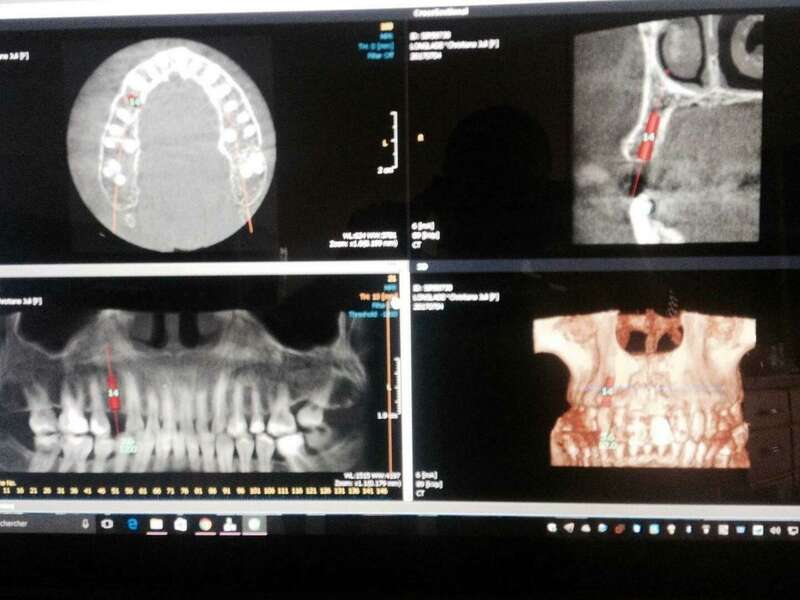 rveh36l20v_1595417810