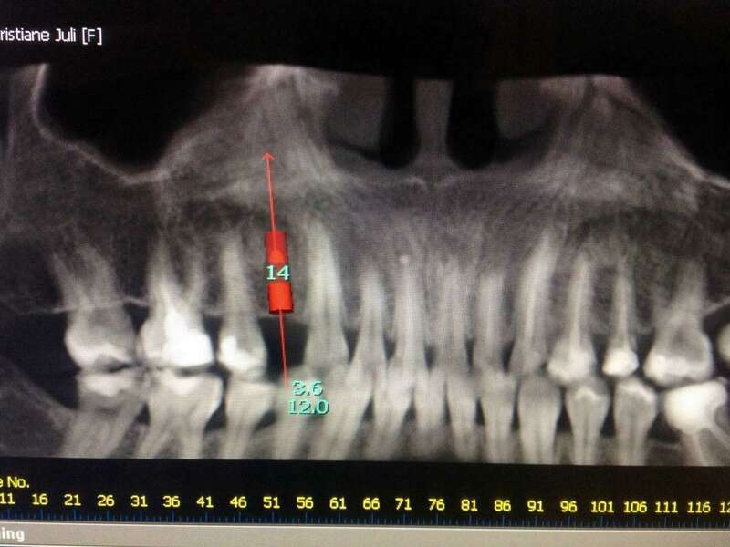 5vr3njtvtl_1595417811