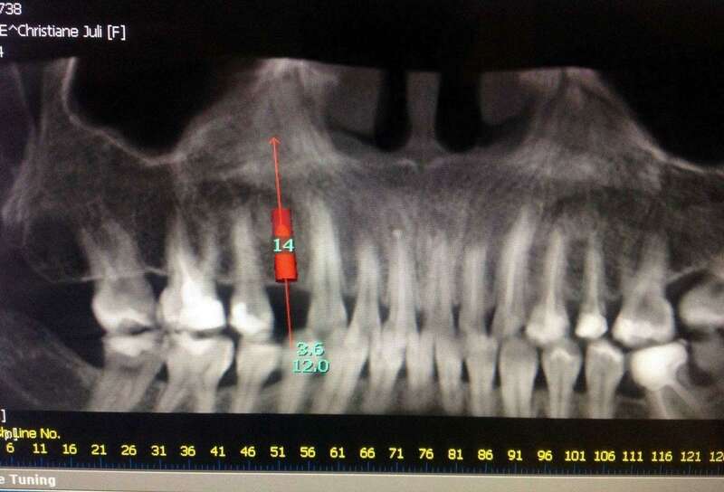 5vr3njtvtl_1595417811