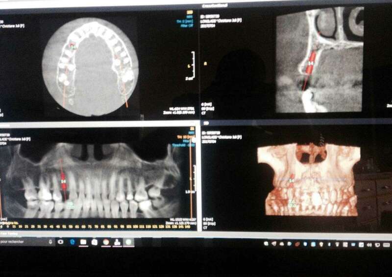 rveh36l20v_1595417810