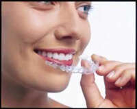 La technique Invisalign® Align Technology