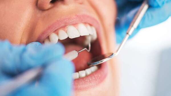 Soins dentaires et diagnostic : comprendre l’examen dentaire