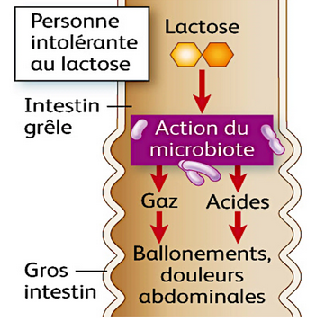L’intolérance au lactose qu’est-ce c’est ?