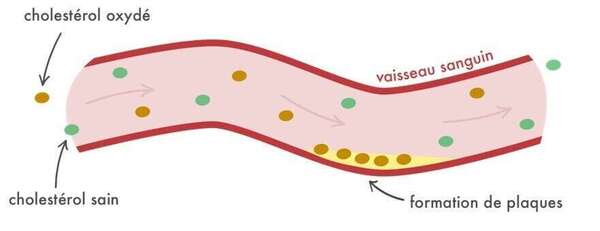 Faisons le point sur le cholestérol