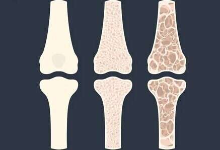 Quelle alimentation pour des os solides?