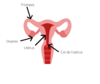 endometriose osteopathie