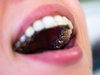 Orthodontie du cabinet