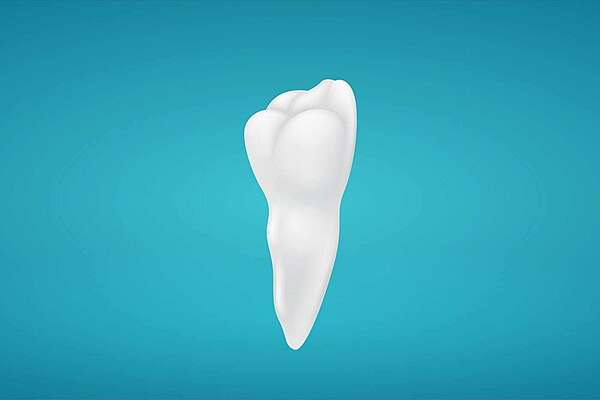 DÉGAGEMENT ORTHODONTIQUE D’UNE CANINE INCLUSE