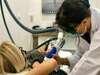 epilation laser