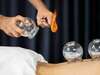 Acupuncture