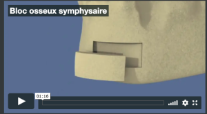 Bloc osseux d'origine symphysaire