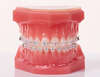 orthodontiste vallauris
