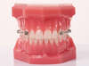 orthodontiste vallauris