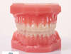 orthodontie vallauris