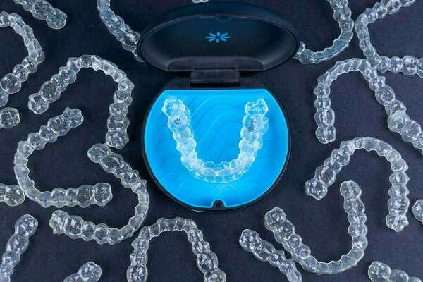 La technique invisalign® – align technology