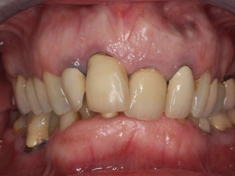 rehabilitation_globale_2