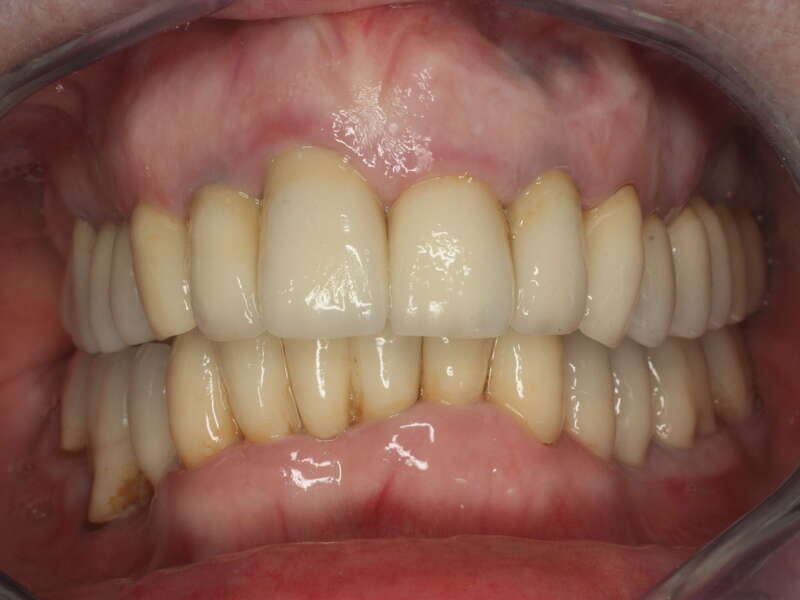 rehabilitation_globale_2__5_