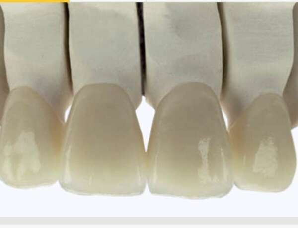 Prothèse dentaire - Casablanca - Maroc