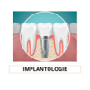 implantologie à Figanières