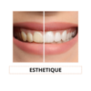 esthetique dentaire à Figanières