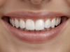 Esthétique du sourire à Toulouse - Dr ZEITOUN et Dr MARTINEZ