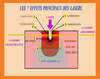 7 effets principaux des lasers