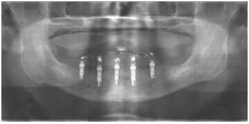 NobelGuide - Evreux - 27