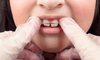 orthodontie interceptive, docteur Danzon, Gray
