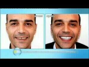 Reportage M6
