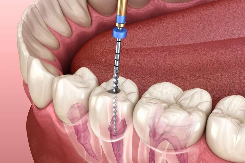Endodontie