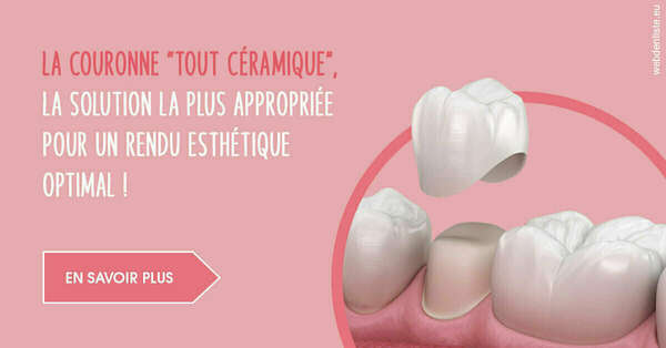 La couronne "tout céramique"