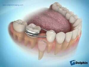 Mainteneur d’espace