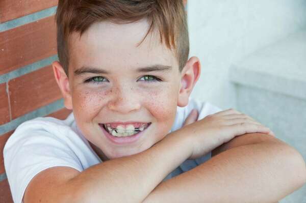 L’ORTHODONTIE FONCTIONNELLE : PRESENTATION