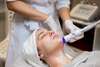 laser menton
