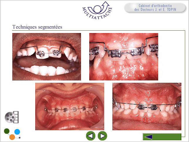 vqe93fwoyi_1603174617