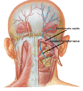 Soulager la névralgie d'Arnold avec la chiropraxie | Blog