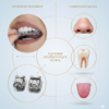 Traitements orthodontiques - Dr Yves CAMBIER