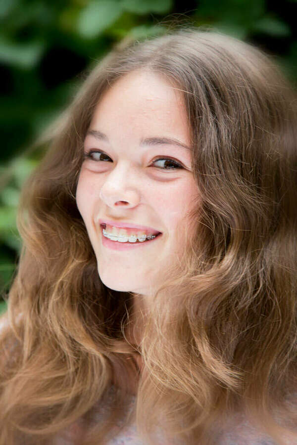 Traitement interceptif et multibagues