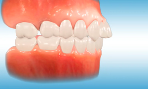 Traitement carrière motion