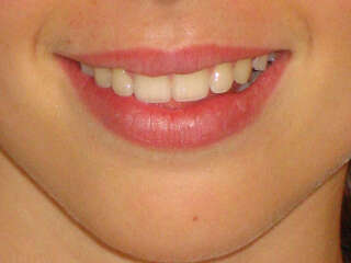 7wa0lwvcjn_1585707334